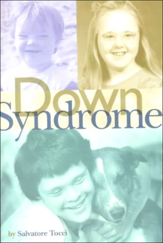 Down Syndrome (Venture Book)